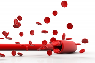 Illustration for article titled What Choices Do Patients Have When Treating Varicose Veins?